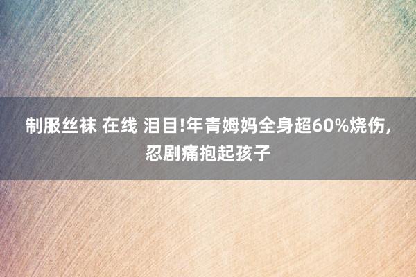 制服丝袜 在线 泪目!年青姆妈全身超60%烧伤，忍剧痛抱起孩子